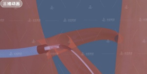 精准医疗与 3D 模型，相辅相成的得力助手​